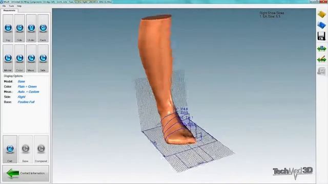 Sensor Canvas - Scanner Ortopédico 3D 2 смотреть онлайн