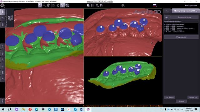 Импорт регистратов, настройка терминальных позиций НЧ