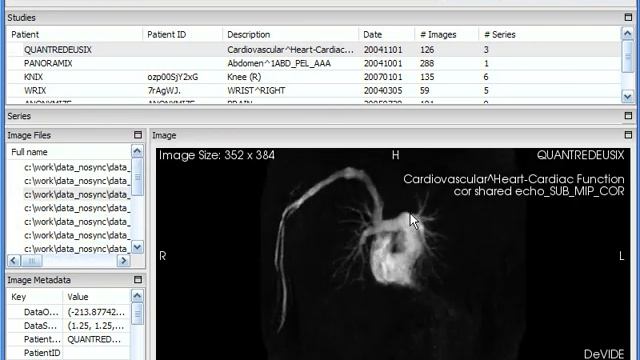 DeVIDE 8.5 DICOM Browser смотреть онлайн