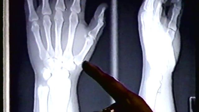 AM PM Clinic 1991 Ad смотреть онлайн