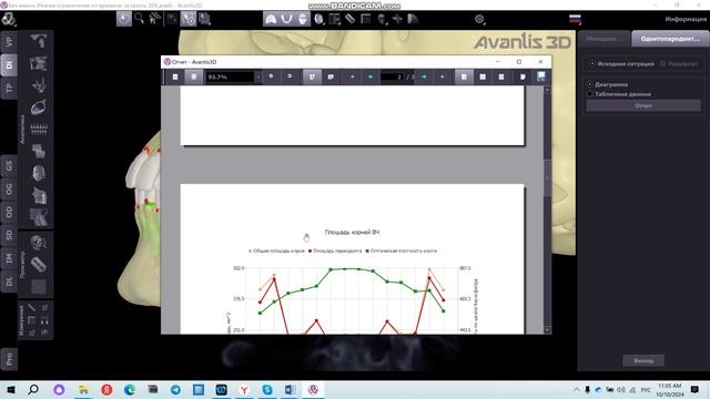 Анализ пародонта