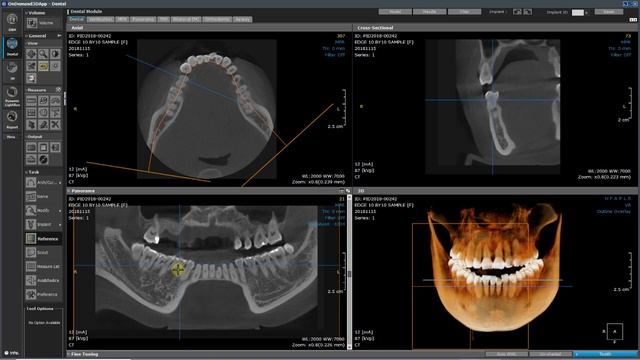 Dental Module Implant simulation Part I v1 смотреть онлайн