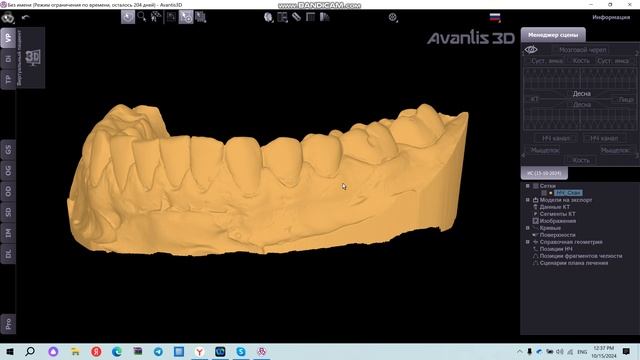 Предварительная обработка сканов