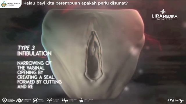 Kalau bayi kita perempuan apakah perlu disunat? | dr. Aulia Rusyda, Sp. A - Dokter Spesialis Anak смотреть онлайн
