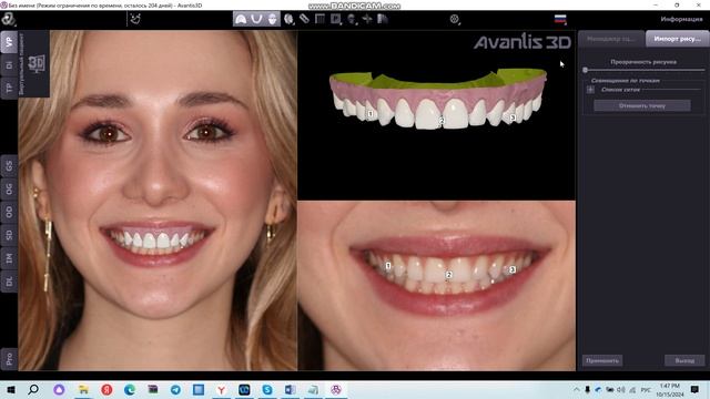 Обработка фото улыбки