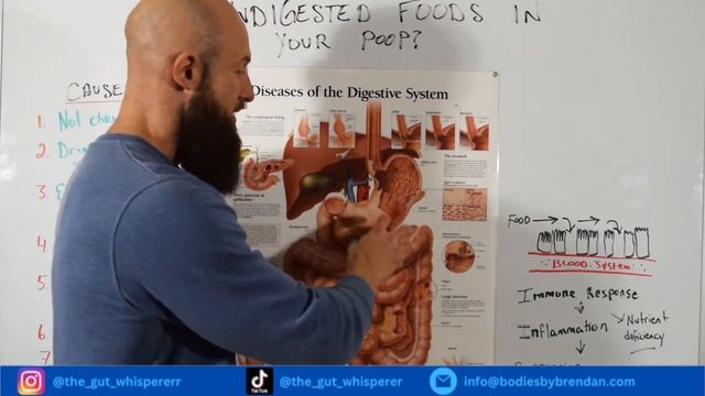 I See Undigested Foods in my Poop (HELP is here) смотреть онлайн