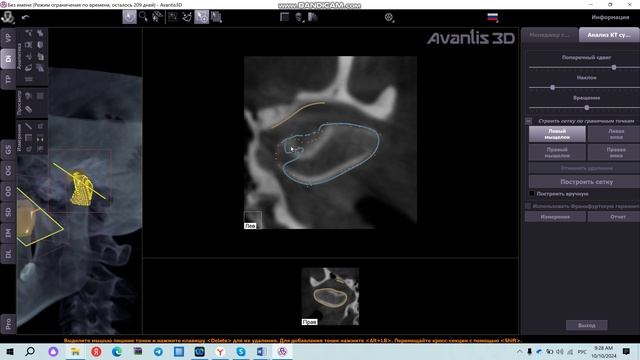 Анализ ВНЧС
