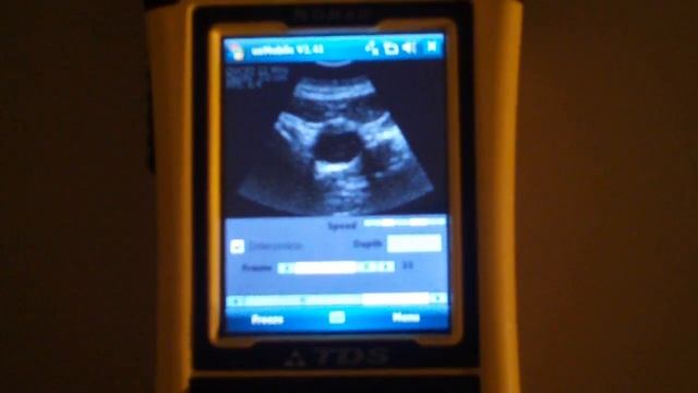 Ultrasound Demo on Trimble Windows Mobile 6 Rugged Handheld смотреть онлайн