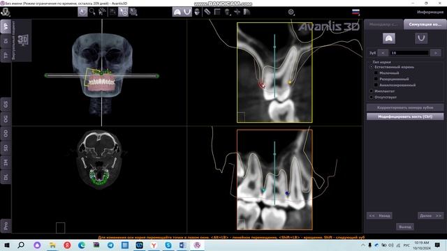 Симуляция корней по КТ