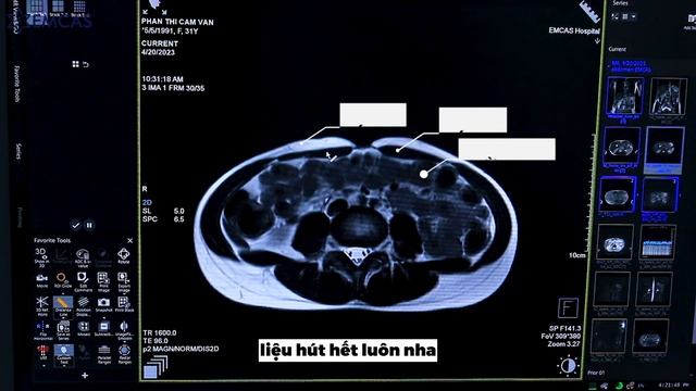 GIẢI MÃ ỨNG DỤNG CÔNG NGHỆ MRI 3.0 TESLA TRONG HÚT MỠ BỤNG смотреть онлайн