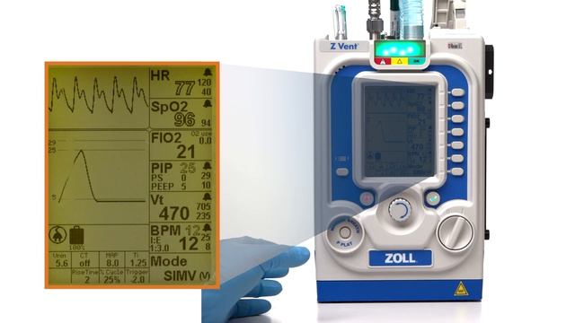 Z Vent® Ventilator Parameter Windows - Module 7 English (US) смотреть онлайн