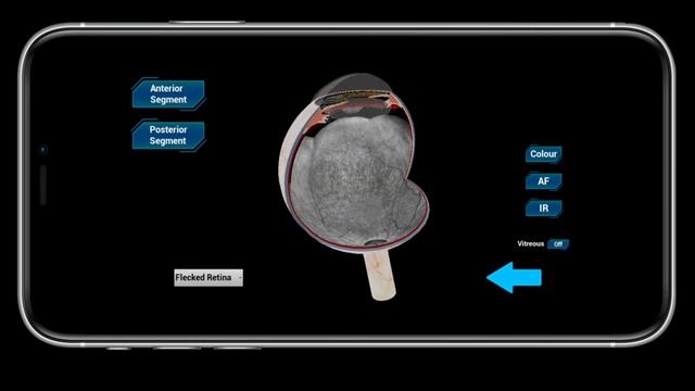Eye MG 3D Software - A Comprehensive Ocular Anatomy and Pathophysiology 3D Atlas смотреть онлайн