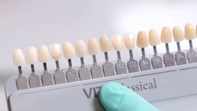 Dental treatment while fasting - MUFTI ABDUR RAHMAN IBN YUSUF смотреть онлайн
