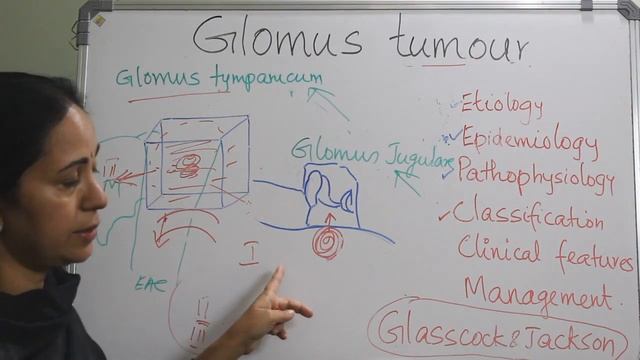 238. Glomus tumor of Temporal bone #surgeryeducation смотреть онлайн