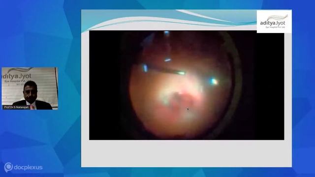 Ocular Surgery For Pellet Gun Injuries