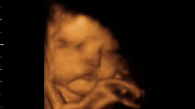 sam and louie window to the womb смотреть онлайн