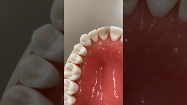 Dental charting video смотреть онлайн