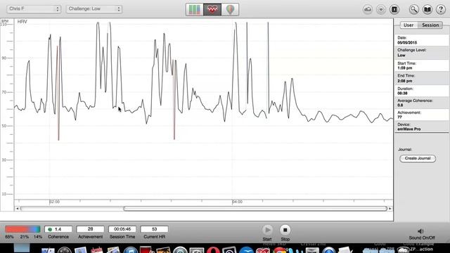 Heartbeat, Breathing and Anxiety Issues Fixed With 1 Easy Breathing Exercise Technique смотреть онлайн