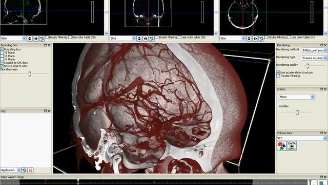 Volumetric datasets' viewer. My first YouTube video) смотреть онлайн