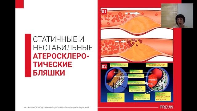 Запись вебинара, 22 июня 2017 г. смотреть онлайн