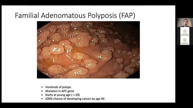 Preventing Colon Cancer: Everything You Need to Know смотреть онлайн