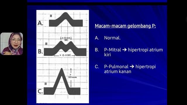 EKG смотреть онлайн