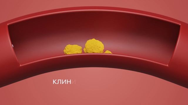 Снижаем холестерин с Мультифлора Эвалар Холестерол смотреть онлайн