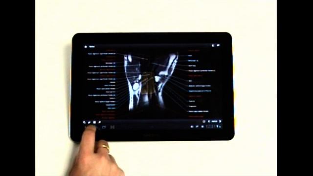 IMAIOS e-Anatomy tablet app for Android смотреть онлайн