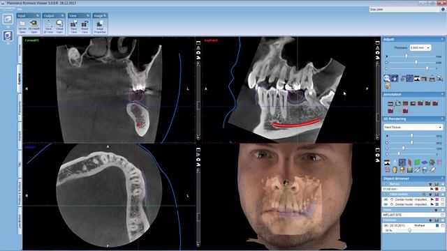 Planmeca Romexis® Viewer is Dental Polyclinic Smile patients imaging software standard смотреть онлайн