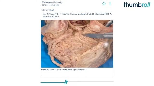 Internal Heart смотреть онлайн