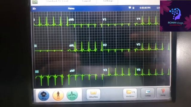 PORTABLE ECG MACHINE смотреть онлайн