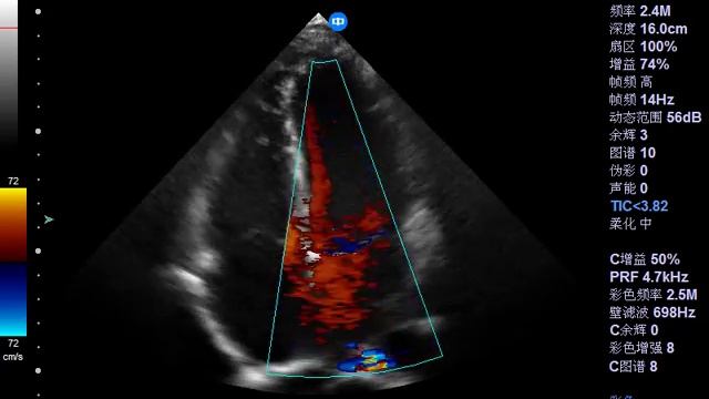 Cardiac Imaging zoncare-Q6 02 смотреть онлайн