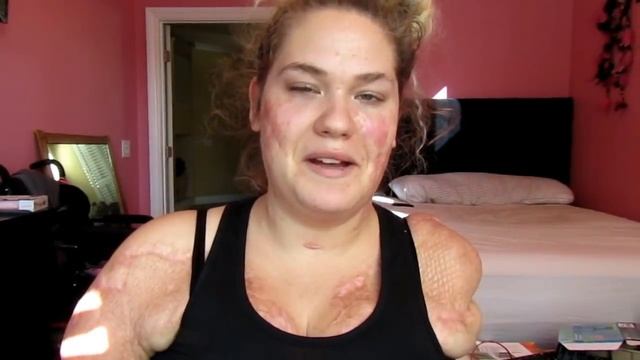 Q&A ♡｜Life As A Quad Amputee | BULLIES? PROSTHETIC PRICES? FAV FOOD? ETC. ♡