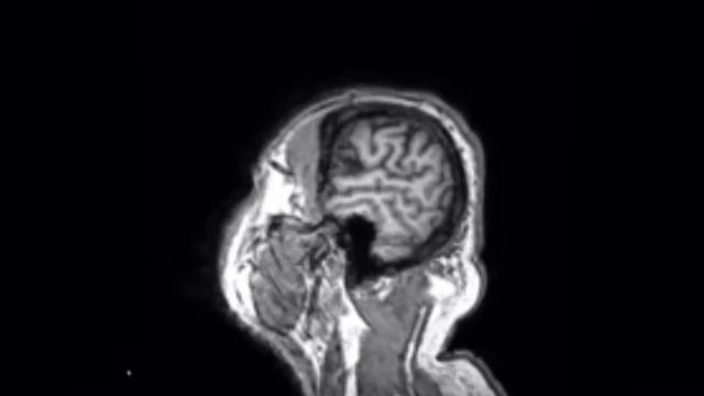 MRI Brain in Color 04/2018 смотреть онлайн