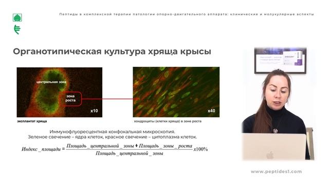 Пептиды в комплексной терапии патологии опорно-двигательного аппарата смотреть онлайн