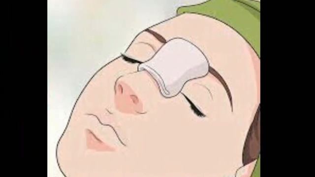 How to Get Rid of Blackheads & Whiteheads At Home in 7 Days | Angel Secrets | смотреть онлайн