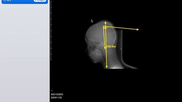 DicomBox HD V1.1 Demo Video