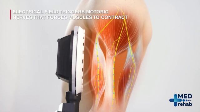 TESLA Former Prestige