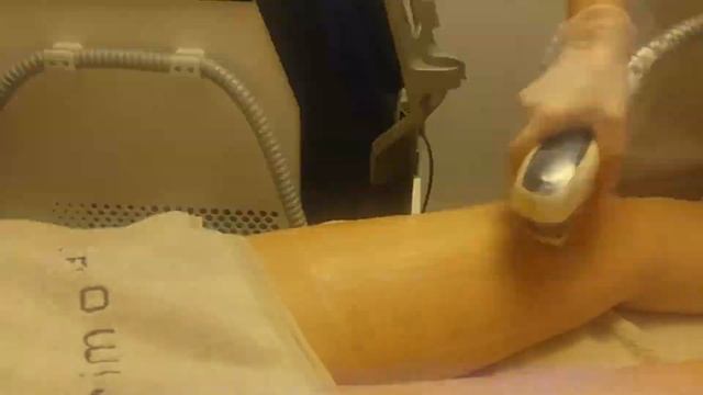 Epilazione permanente Metodo CentoXCento Liscia смотреть онлайн