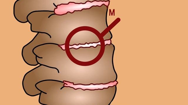 Как сохранить здоровье костей и суставов. Организм человека. Нескучная анатомия смотреть онлайн