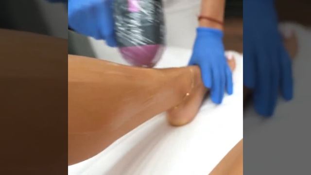 Лазерная эпиляция смотреть онлайн