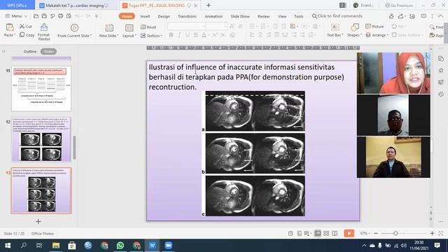 Diskusi Kel 7 Aplikasi Paralel Imaging Pada Mri Cardiac