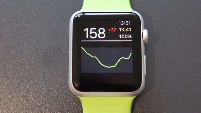 Nightguard (formerly known as Scoutwatch) Apple Watch App for the Nightscout Backend смотреть онлайн