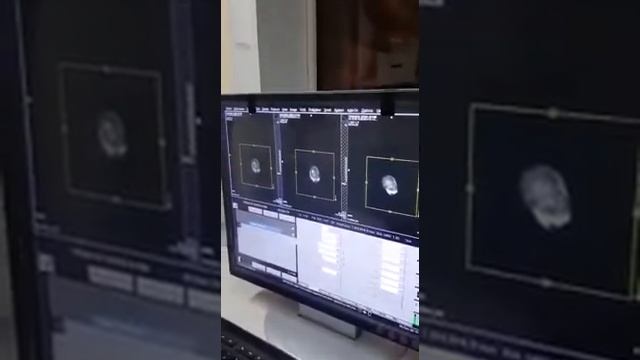 Mri Ankle 1 Siemens 1.5Tesla смотреть онлайн