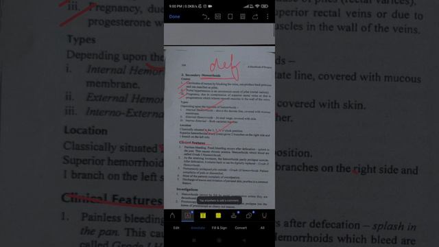 HEMORRHOIDS lecture | 10 marks Question | Surgery lecture смотреть онлайн
