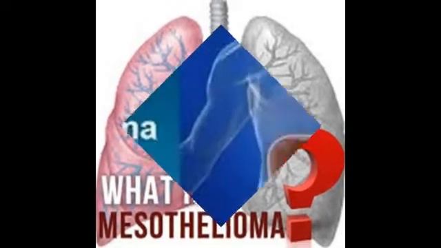 san diego mesothelioma lawyers смотреть онлайн