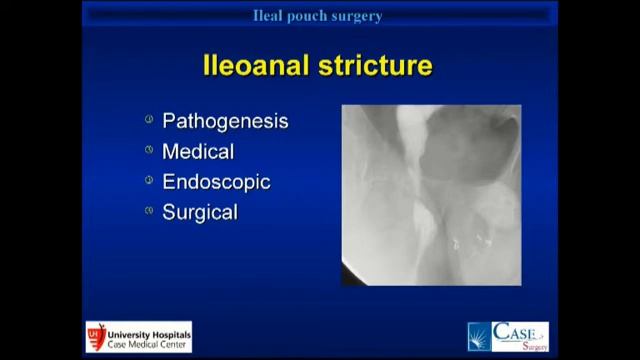 -Dr Conor P. Delaney: Manejo de complicaciones ileo-anal. смотреть онлайн