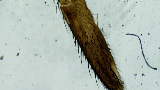 Patte De Mouche Au Microscope ...