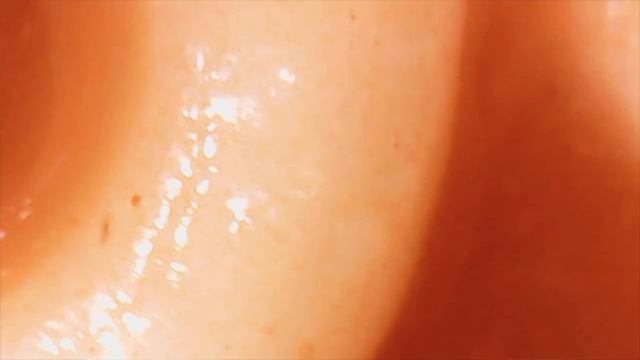 GROSS MOULD & Guess Which