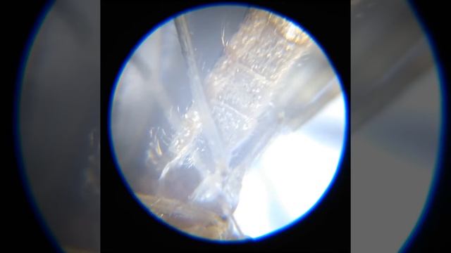 Комар под микроскопом